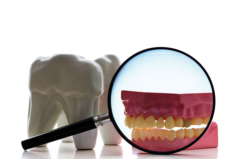 Root Canal Treatment in Mount Airy