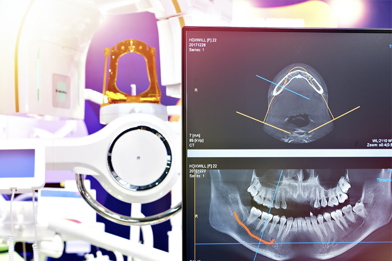 Digital X-Rays in Mount Airy